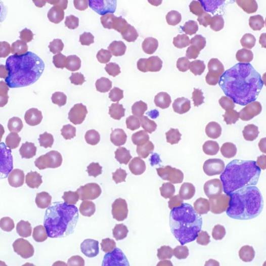 Feline leukemia virus (FeLV)